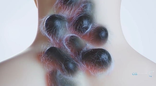 CGcircuit – Stylized Skin Growth in Houdini  第1张